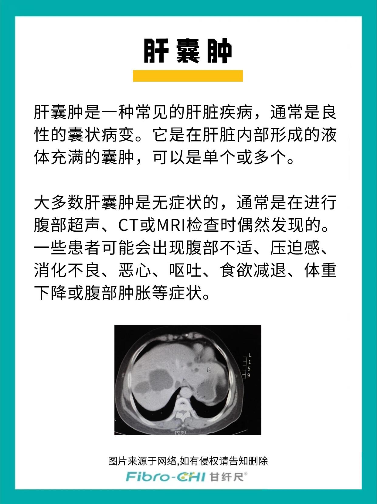 需要治疗吗? 肝囊肿是一种常见的肝脏疾病,通常是良性的囊状病变.