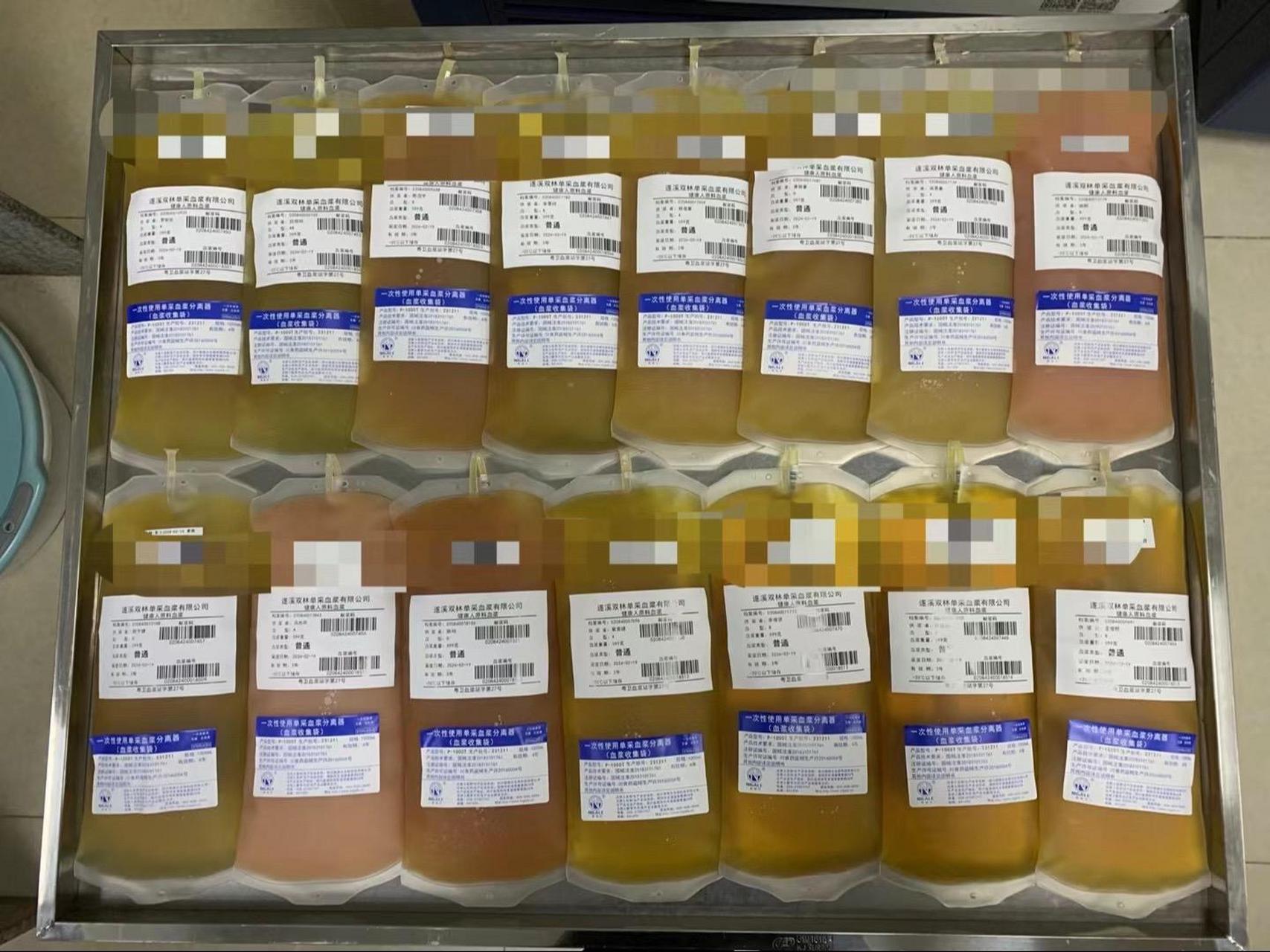 因为每个人的身体状况不一样 所以血浆颜色也不一样 像图31566