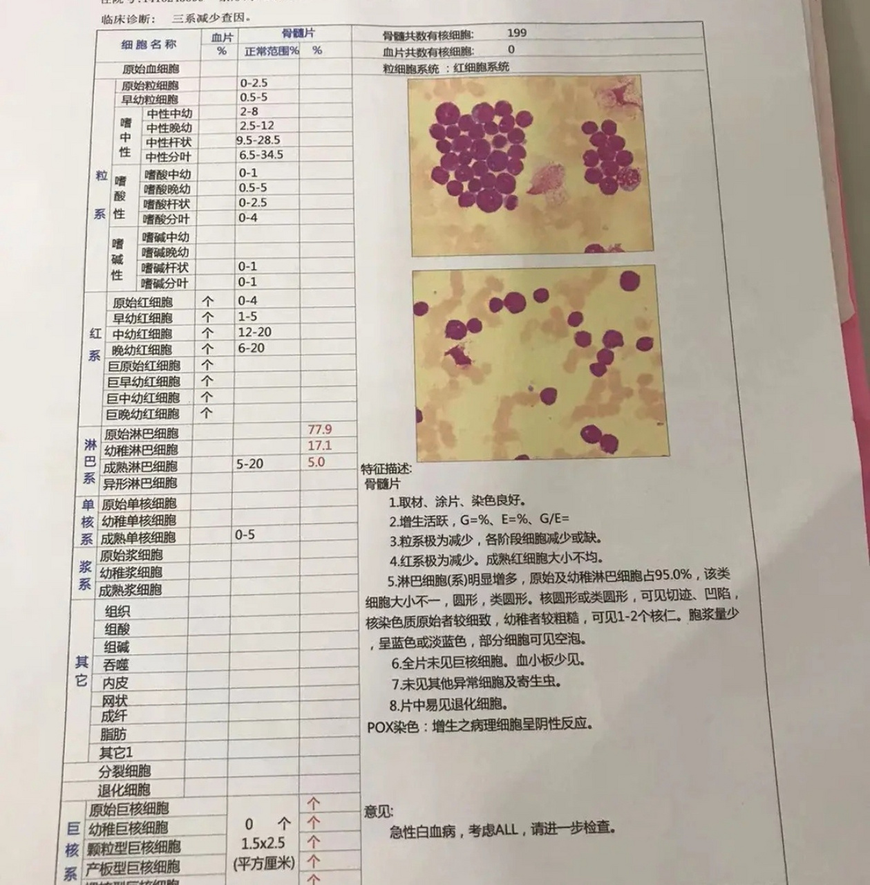 骨穿报告图片