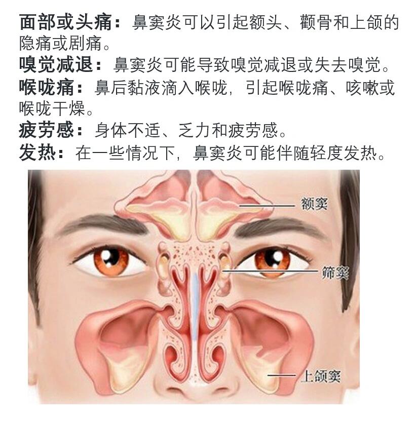 鼻粘膜位置图片图片