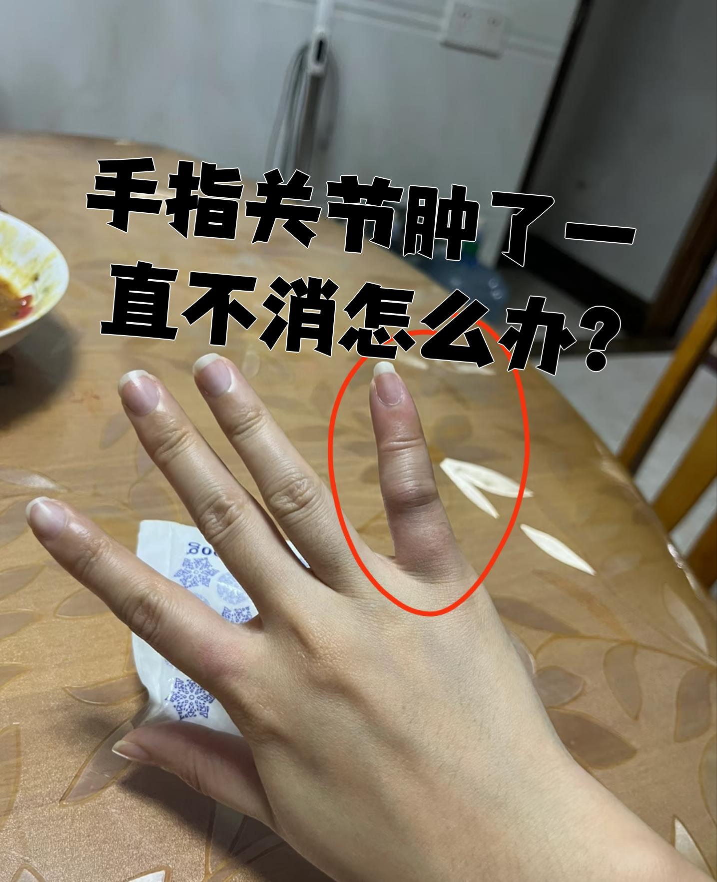 手指关节肿了一直不消怎么办?