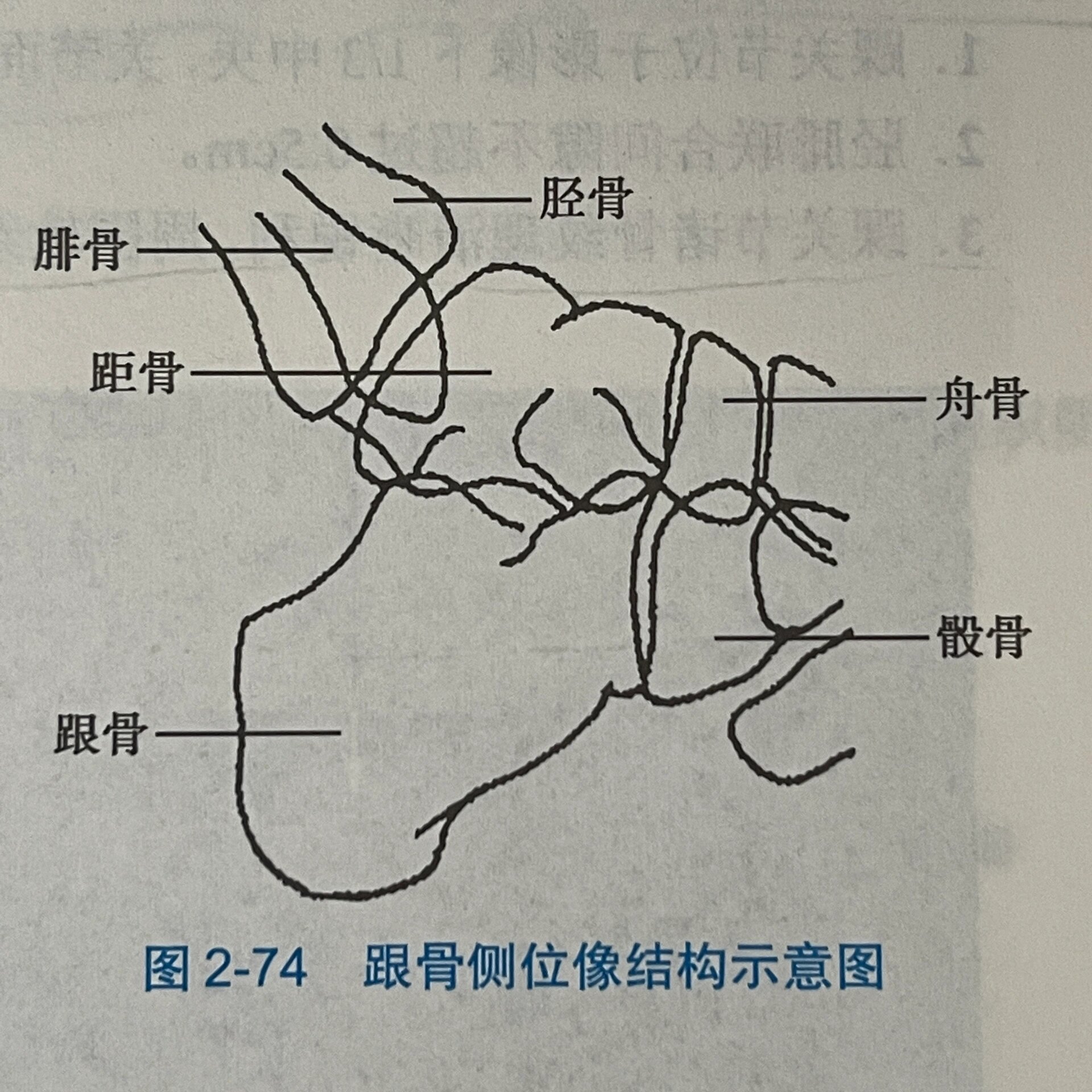 根骨轴位图片