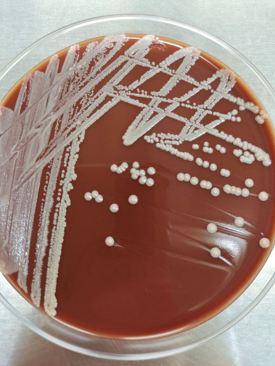 医学检验微生物,纹带棒杆菌     痰液标本,上图为放置了72h的菌落形态