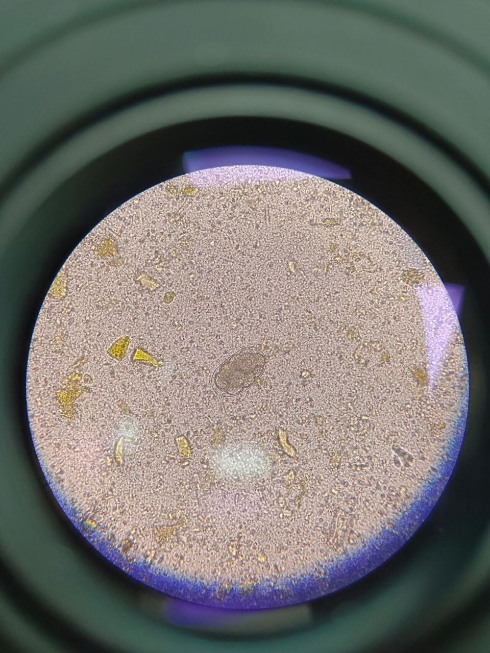 找到一典型钩虫卵 果然还是要靠显微镜94自己双眼找, 更清晰典型