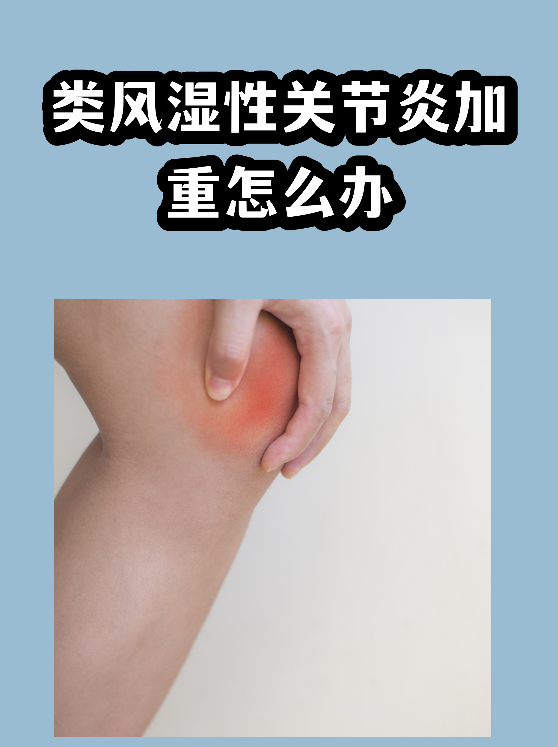 安定医院代挂专家号服务-缓解就医焦虑的简单介绍