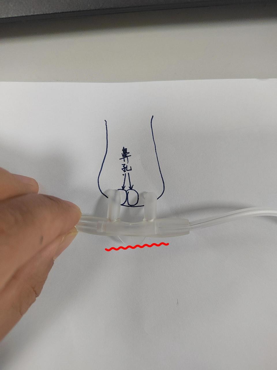 求助各位老师们,鼻导管吸氧时正确放置方法为图二还是图三,以及原因