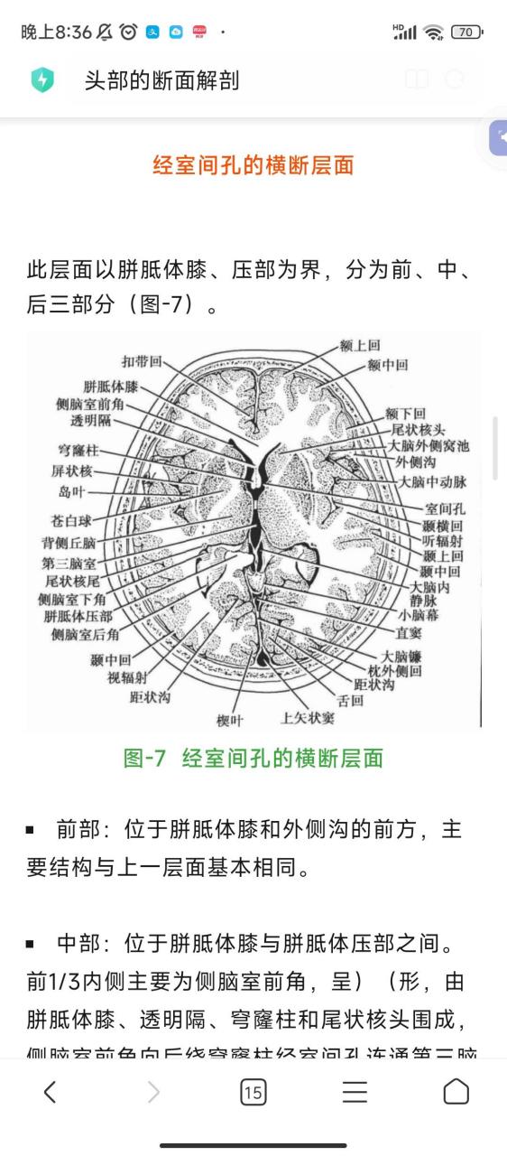 侧脑室断层解剖图图片