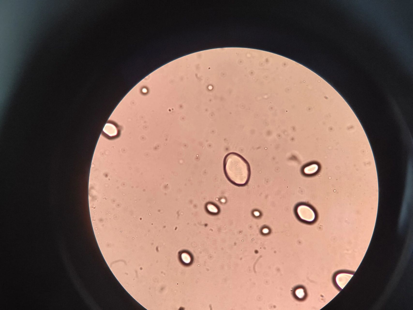 马铃薯淀粉粒显微镜图片