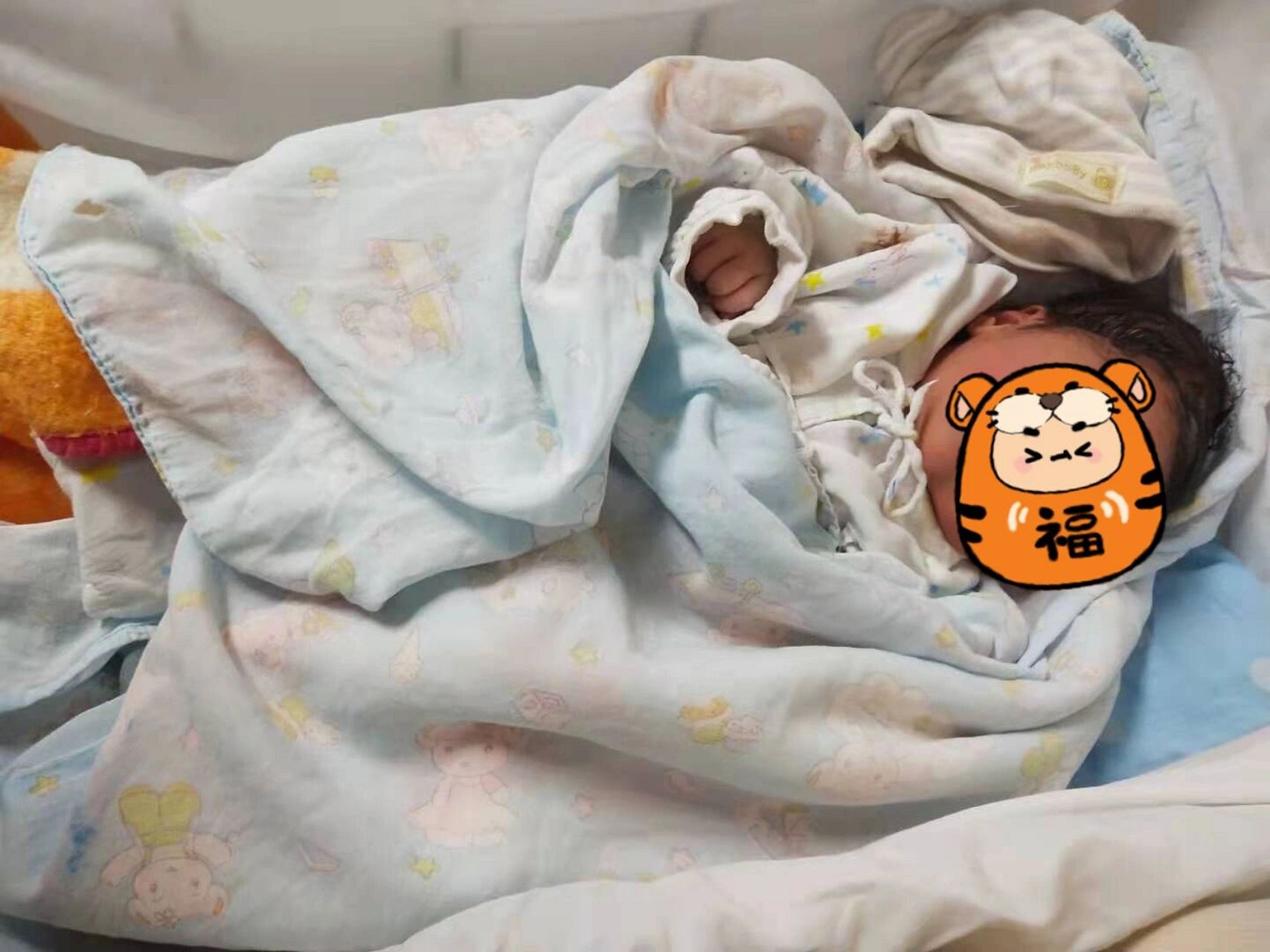 关于新生儿顺产头皮血肿 小宝宝顺产经常会看到头被挤变形的,如果只是