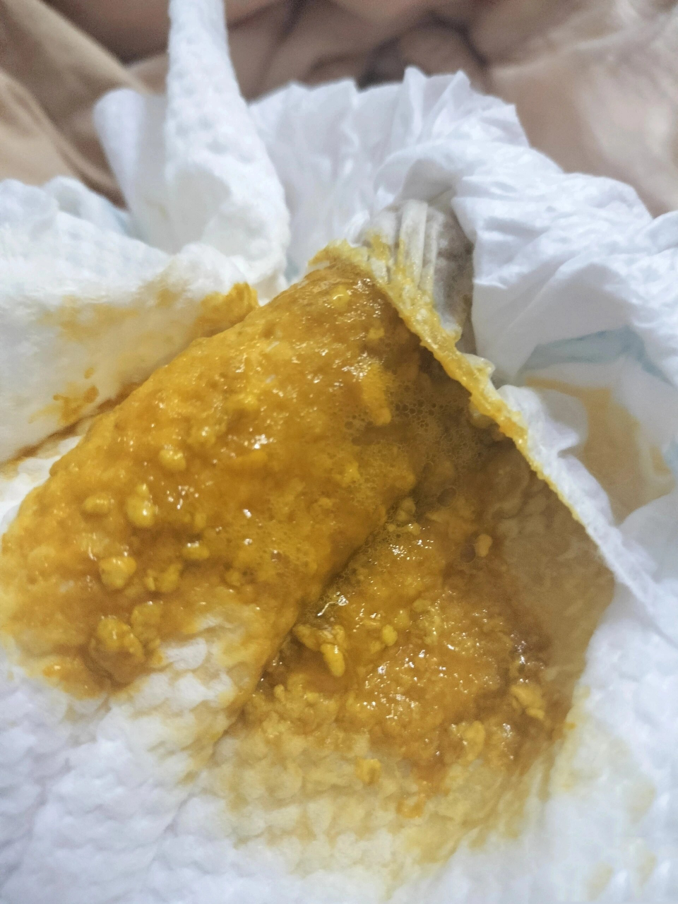 宝宝拉粑粑像果冻状,要不要去医院看?