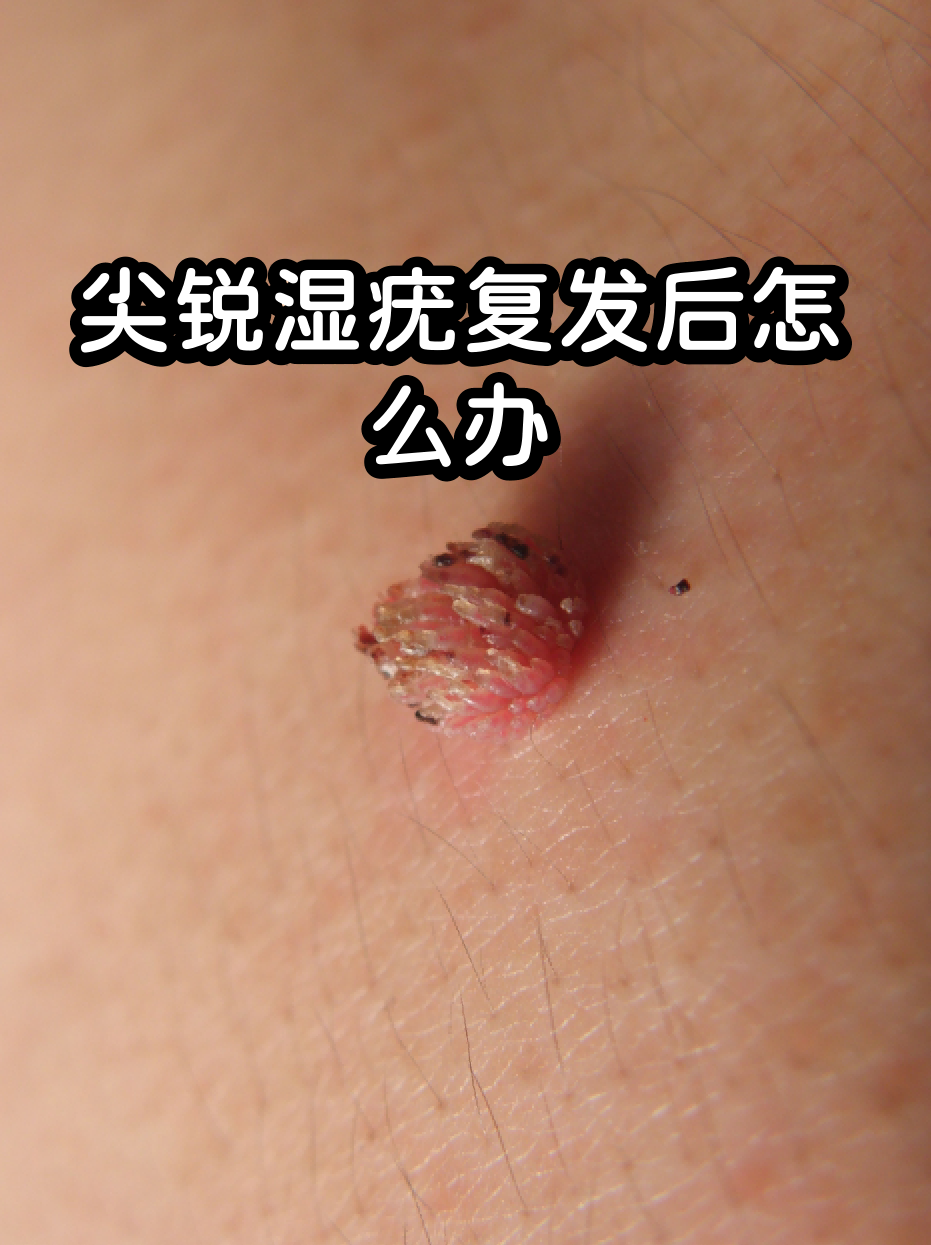 关于安定医院代挂专家号服务缓解就医焦虑的信息