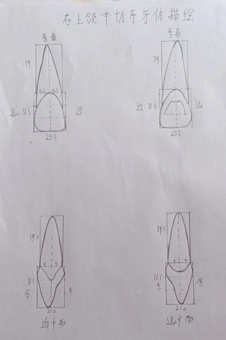 上颌中切牙素描画法图片