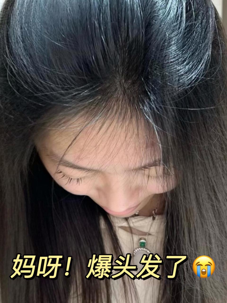 发缝还贼大 直接能在发缝上种田…… 简直没眼看!