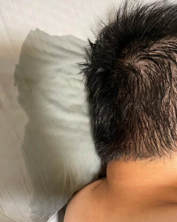 如果发生在睡梦中叫梦遗;如果清醒时或无梦状态下精液流出,就叫滑精