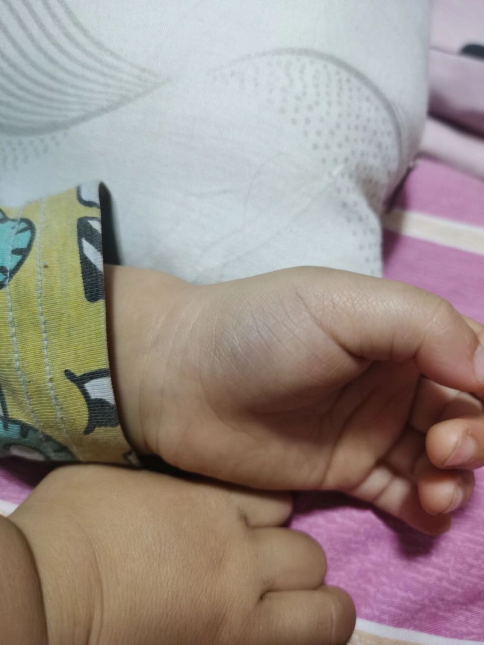 22个月宝宝从小时候到现在手掌那块一直都是青的咋回事?