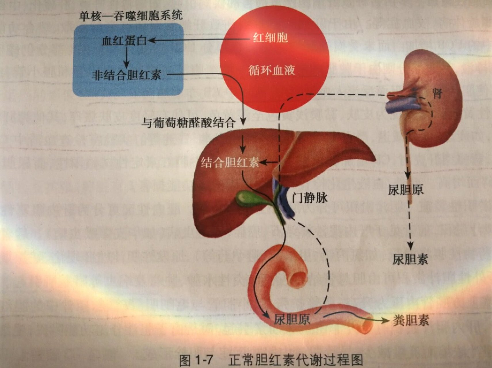 胆红素的代谢过程图片