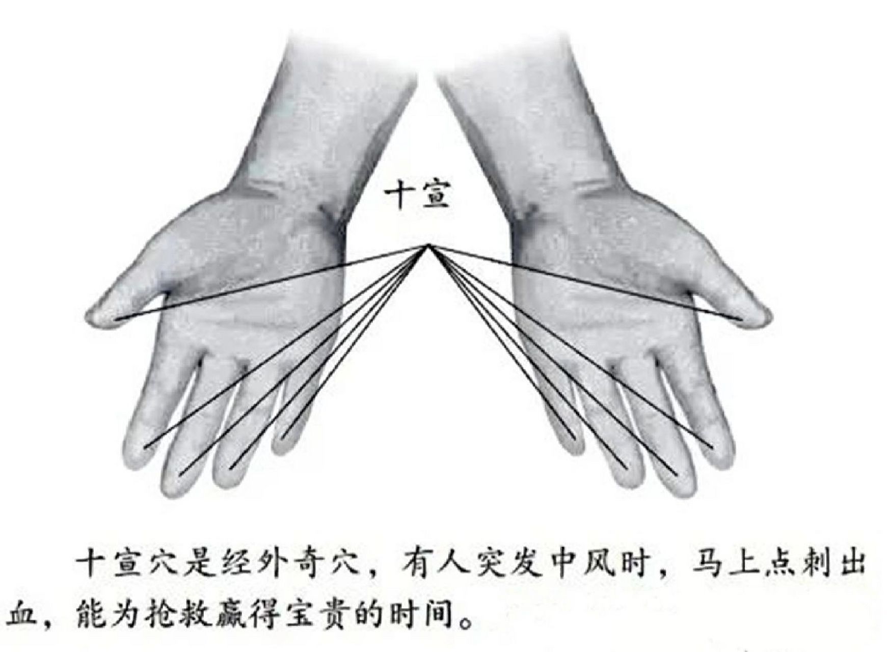 十宣就是十个手指或者脚趾末端,一般刺血可以快速快速缓解脑部压力