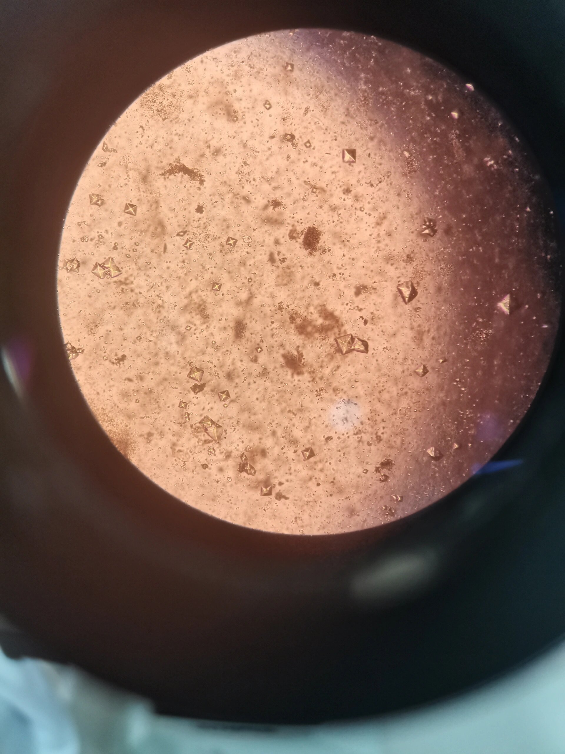 超级好看的草酸钙结晶 这个结晶真的好好看,满视野都是