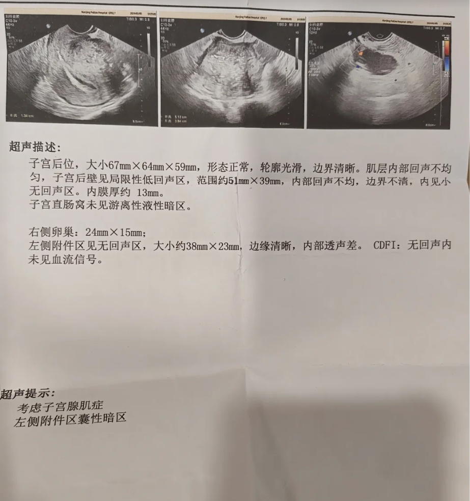 宫颈彩超全称是"经阴道彩色超声",它是一种能实