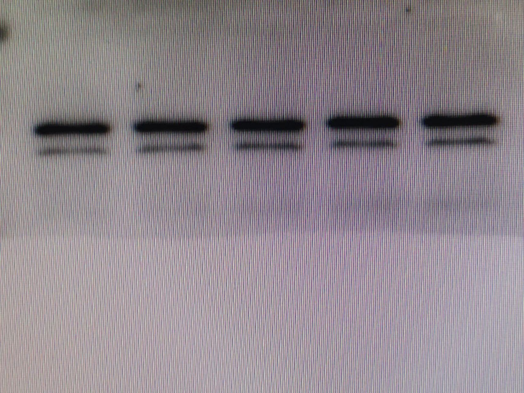 wb 内参两条带 刚开始跑wb,为什么gapdh会有两条带