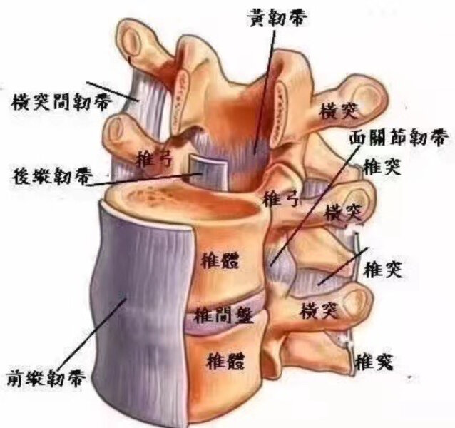 【腰椎管狭窄—-黄韧带,后纵韧带肥厚】当脊柱出现退化不稳定时,黄