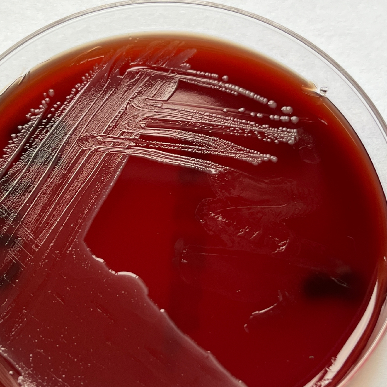 粪肠球菌镜检图片
