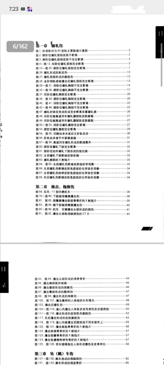 铁道损伤pdf图片