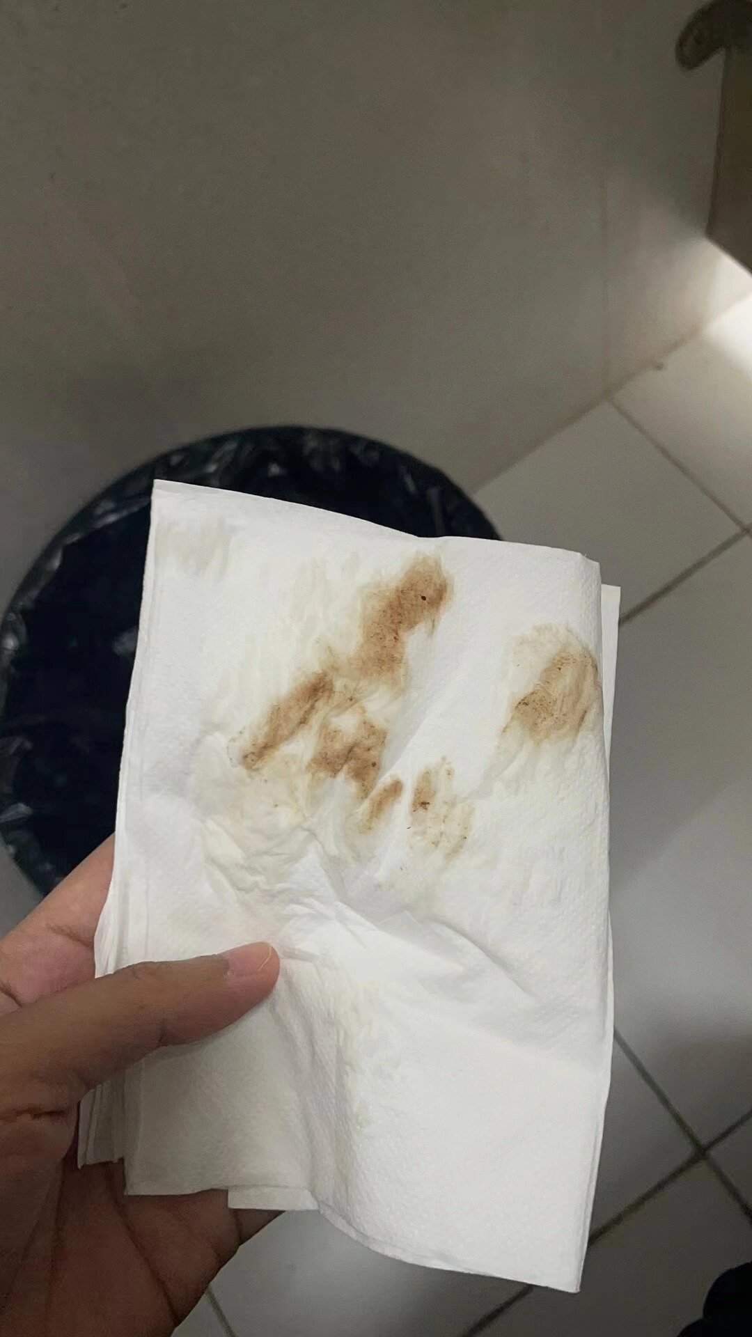 试管🧪移植第8天,流褐色分泌物