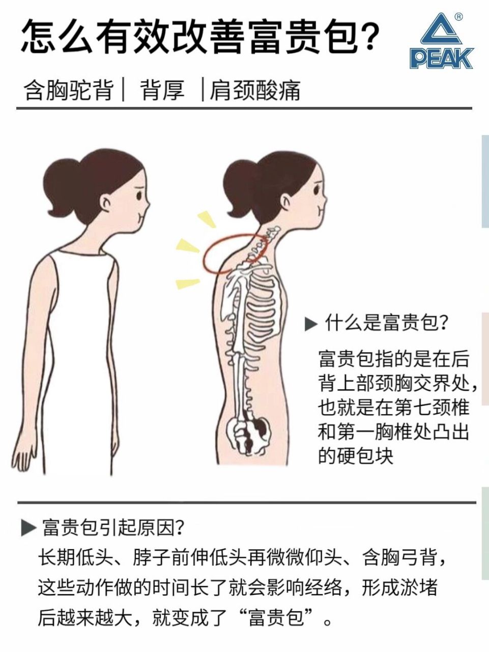 靠墙自然站立,双脚与跨同宽,后脚跟,臀部,肩胛骨贴墙,如果头部
