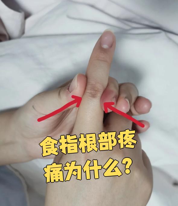 食指根部疼痛常见原因有三种:外伤,狭窄性腱鞘炎和痛风