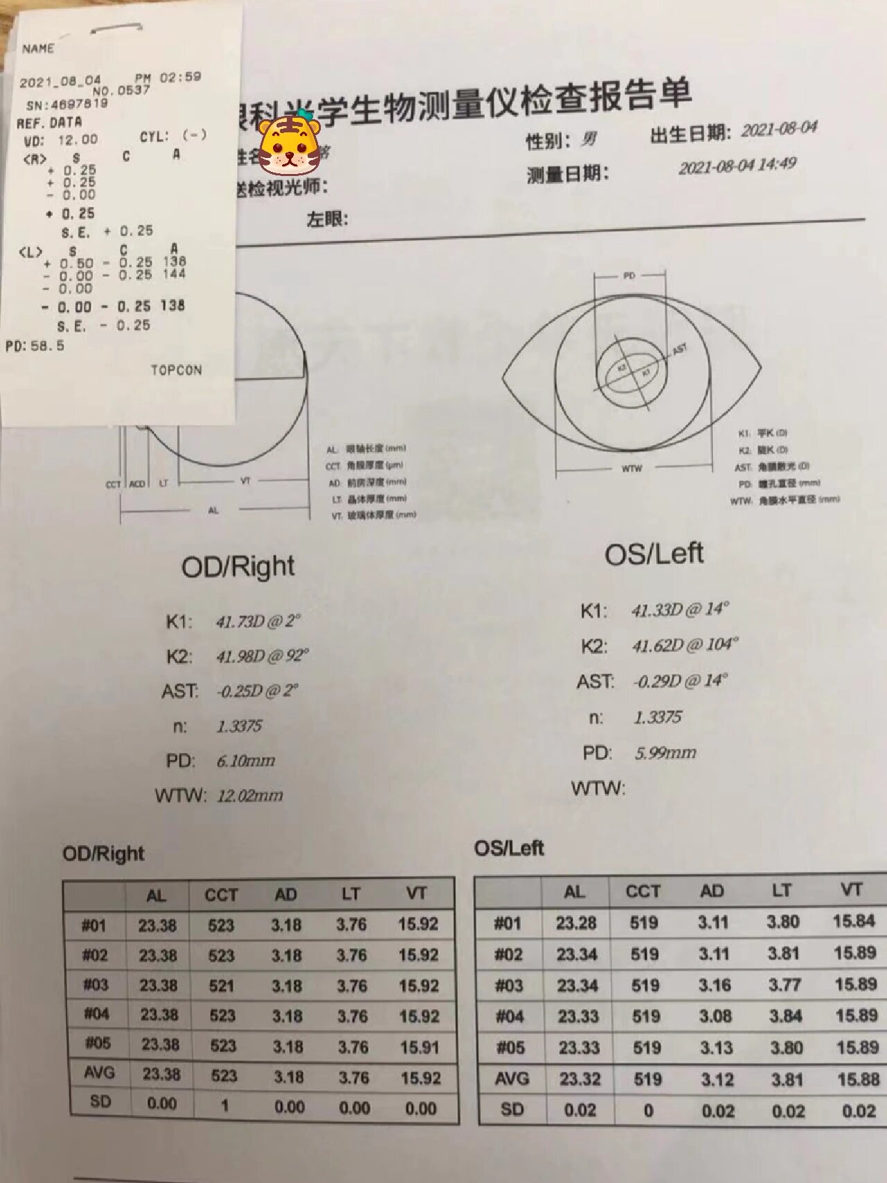 艾尔兴哺光仪 失明图片