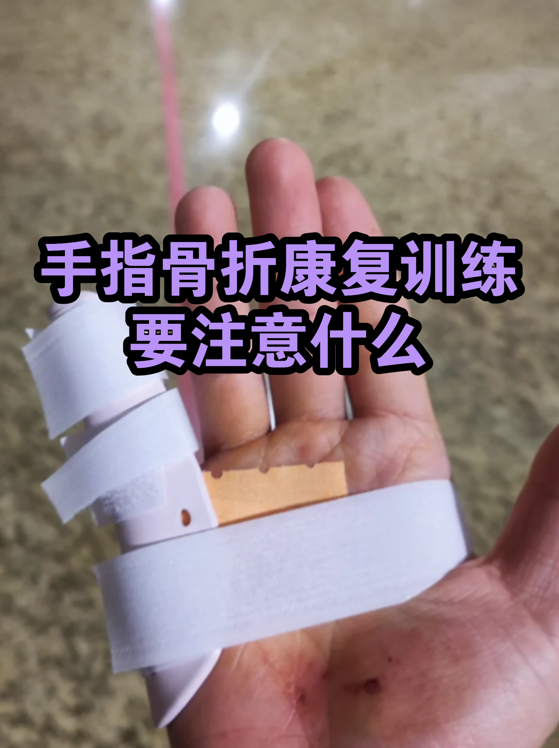 回龙观医院代诊挂号服务流程康复训练专业指导，恢复效果更佳的简单介绍