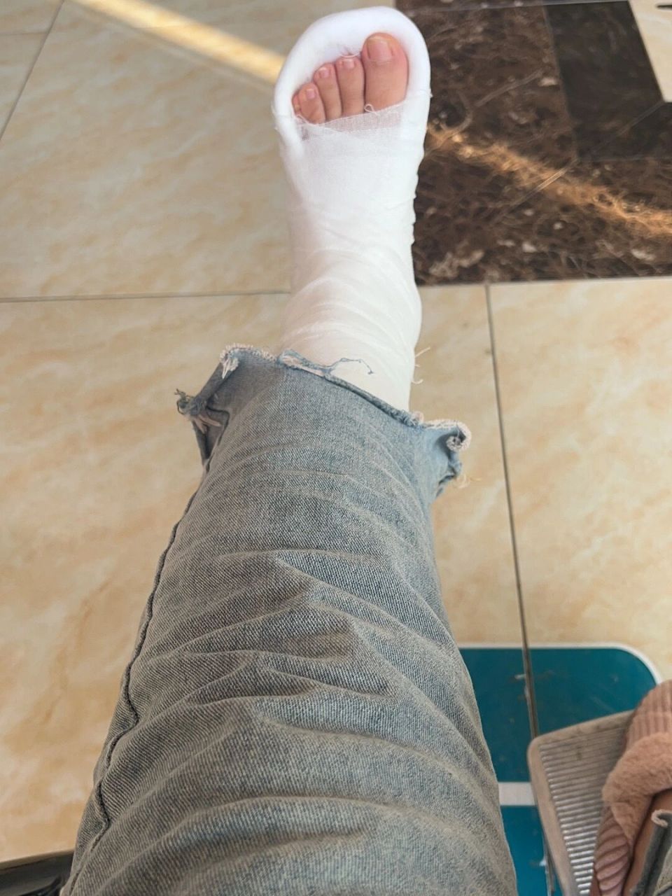 足跟骨裂  姐妹们,足跟骨裂都是多久负重下地了呀,医生惜字如金!