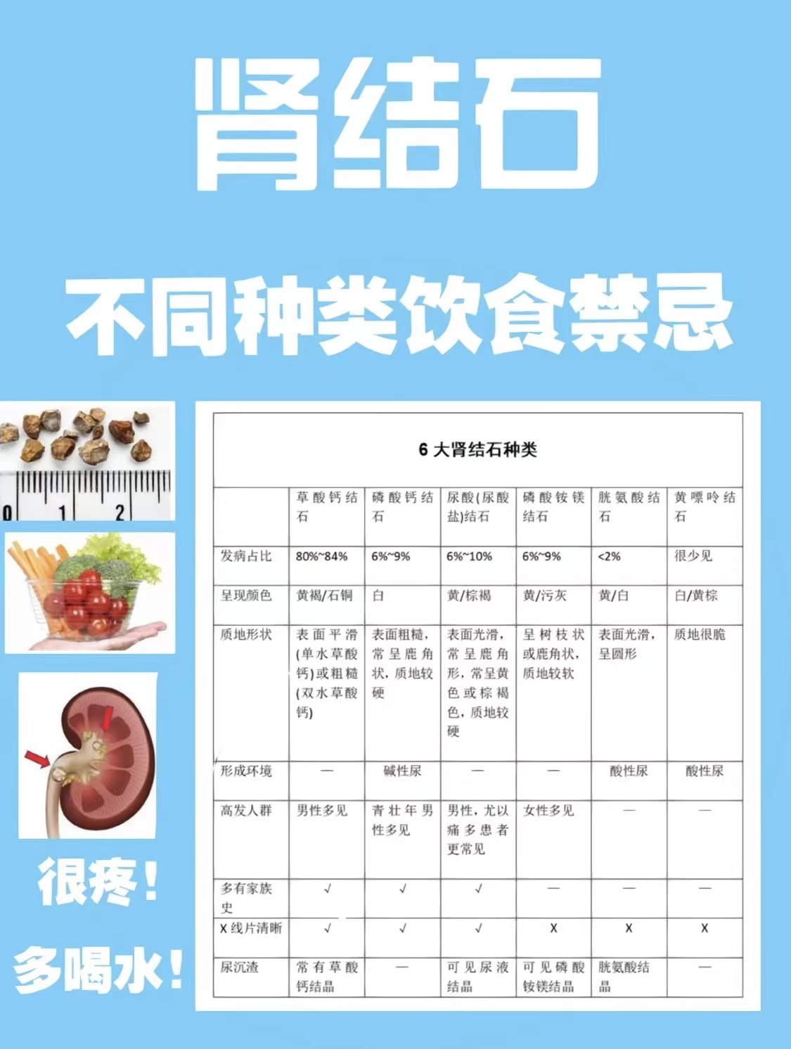 肾结石饮食禁忌图片