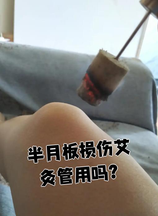 半月板损伤常会引起膝关节疼痛,肿胀和活动受限