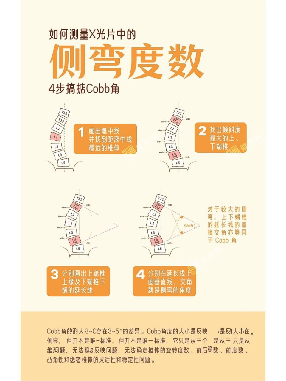 脊柱侧弯测量方法图片图片