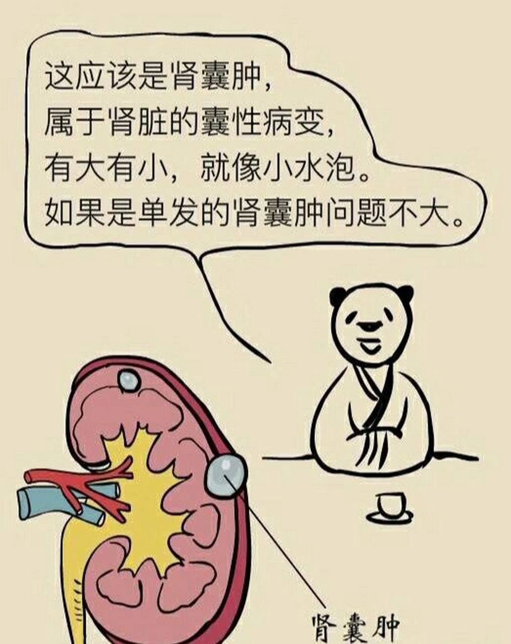 那么肾囊肿是怎么回事?需要治疗吗,今天作
