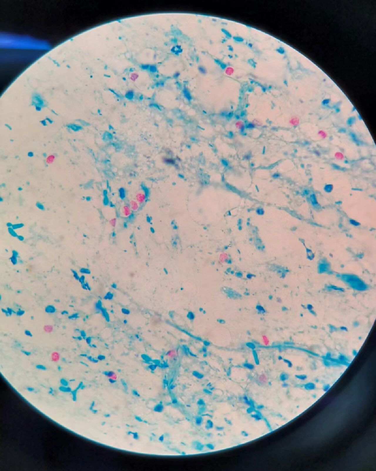 隐孢子虫 属顶复器门 孢子纲  球虫亚纲 真球虫目 艾美耳亚目  隐孢子