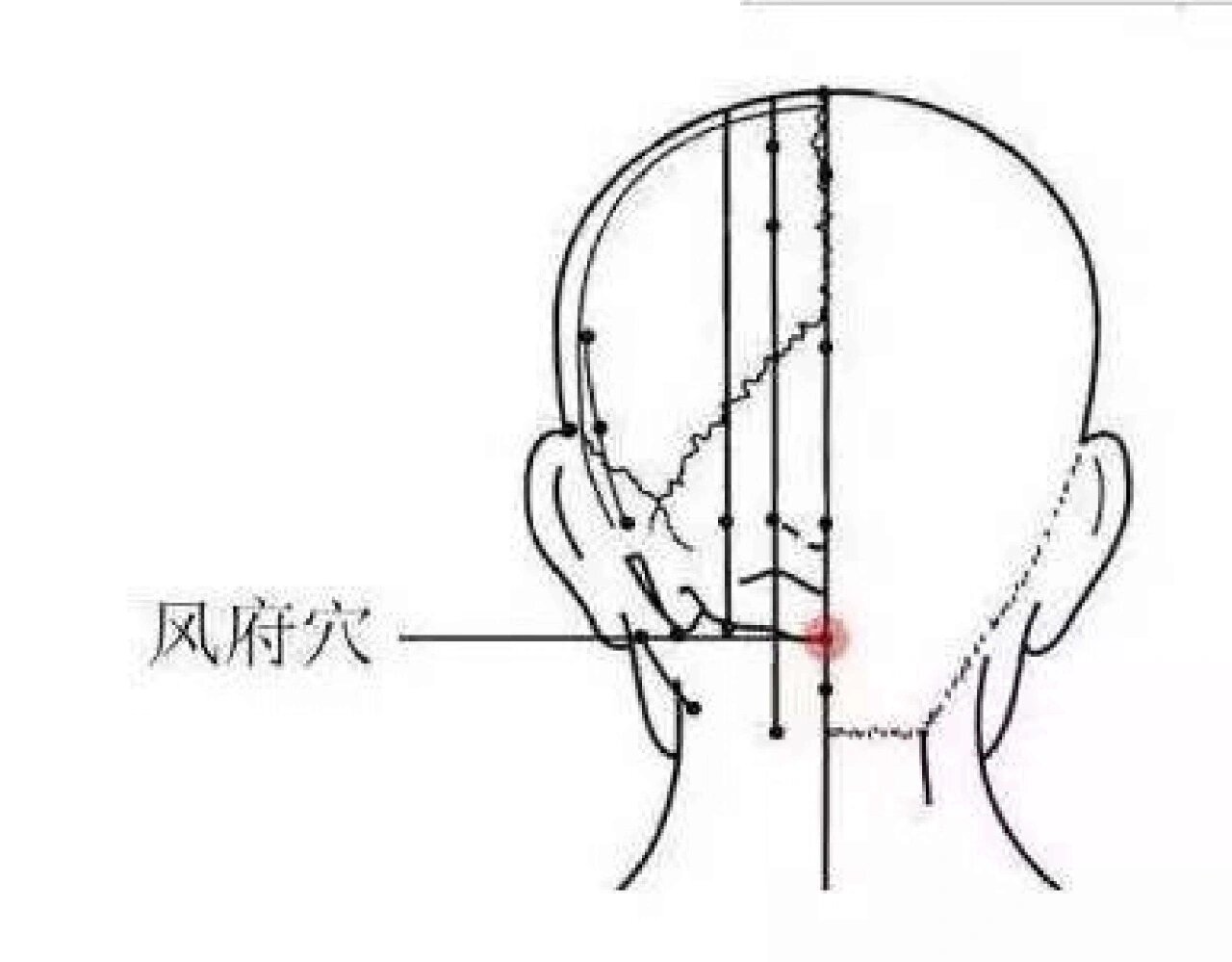 在项部,当后发际正中直上1寸,枕外隆凸直下,两侧斜方肌之间凹陷处.