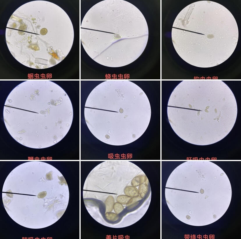 猪囊尾蚴虫卵图片