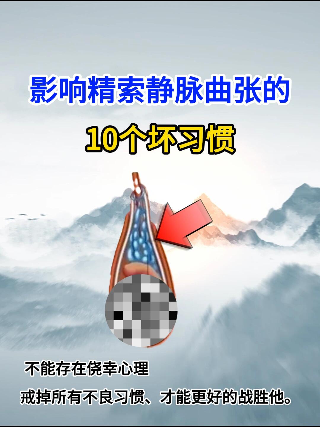 精索静脉曲张 影响精索静脉曲张的10个坏习惯 不能存在侥幸心理.