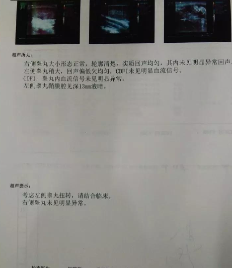 睾丸有下坠感还疼,可能是这些原因: