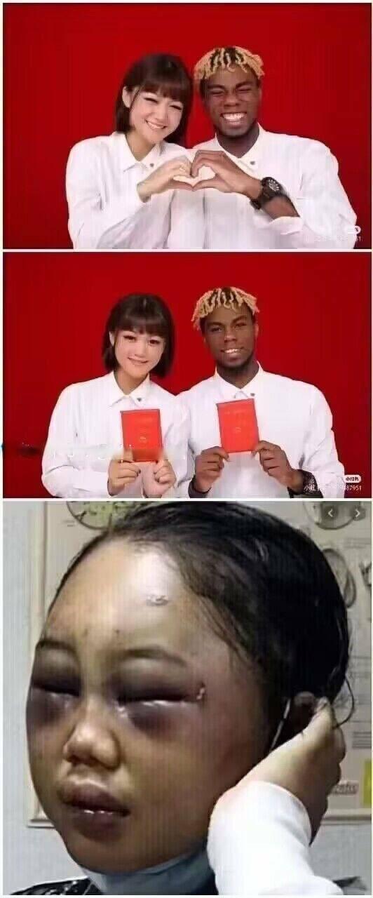 被黑人家暴,都肿成了猪头