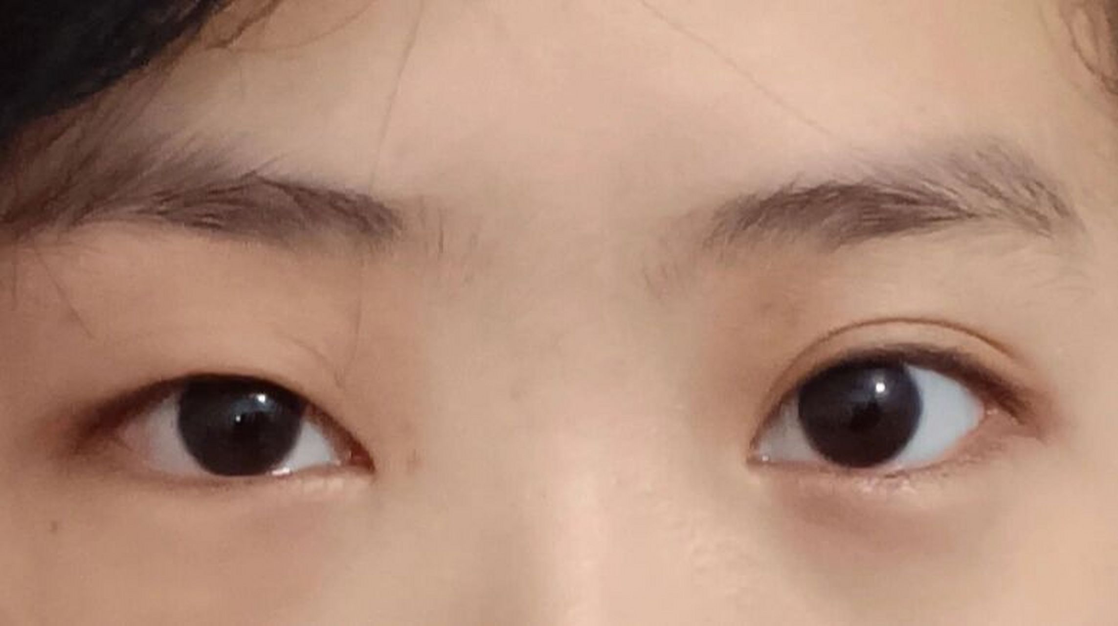 妈妈:"龙凤眼"
