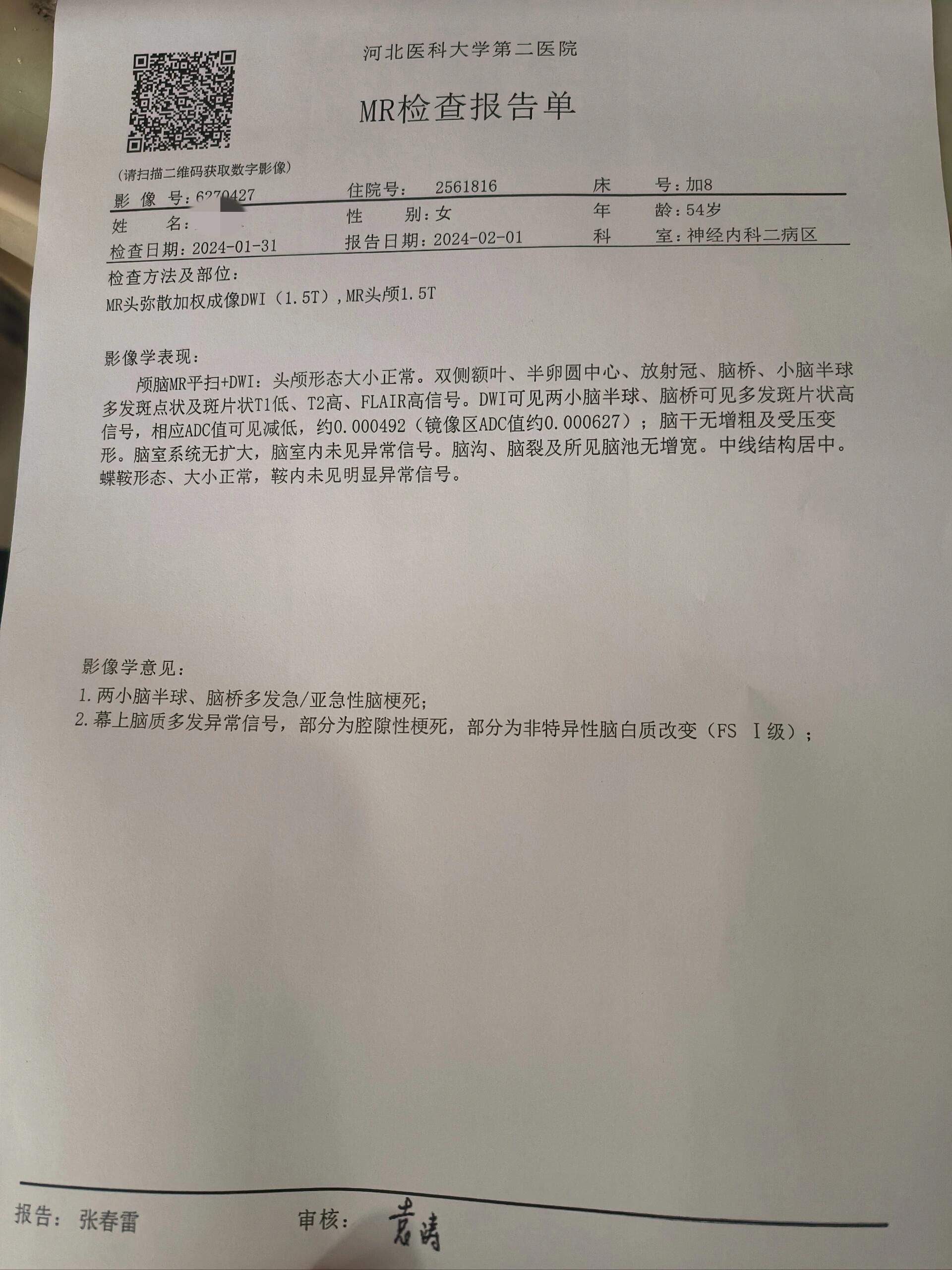 双侧小脑,脑桥梗死,大脑基底动脉重度狭窄 天塌下来了,妈妈突发脑梗