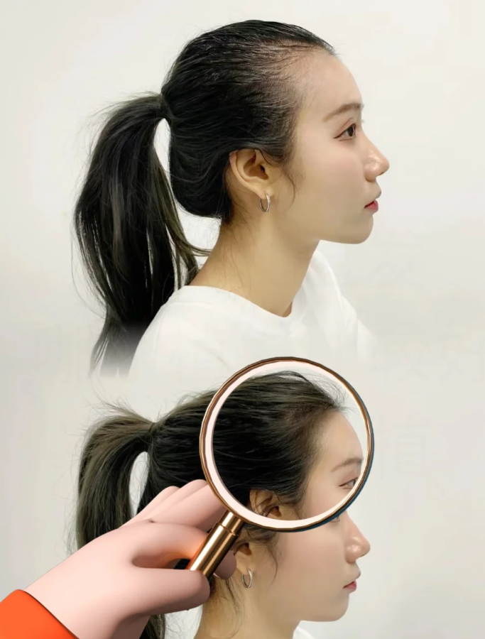 姐妹植发打卡(姐妹植发打卡文案搞笑)