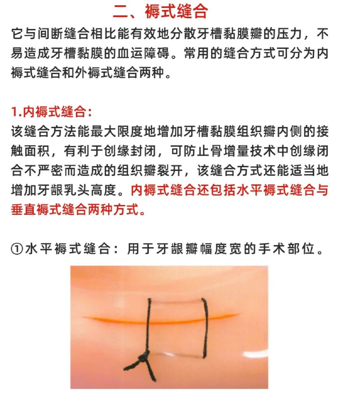 口腔常用的缝合方法及注意事项图解