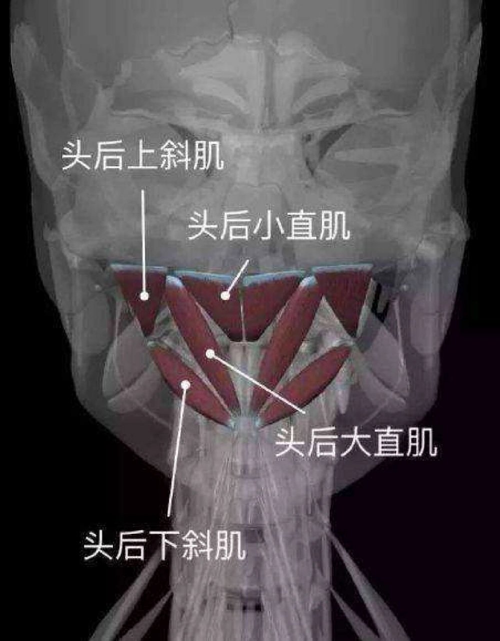 头后小直肌图片图片