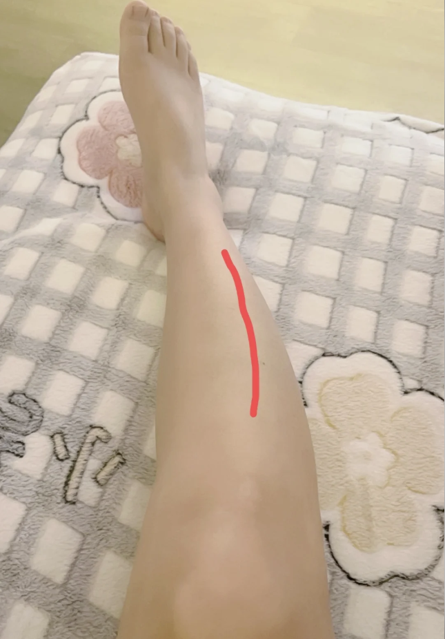 运动后小腿迎面骨疼常见原因有以下几种: