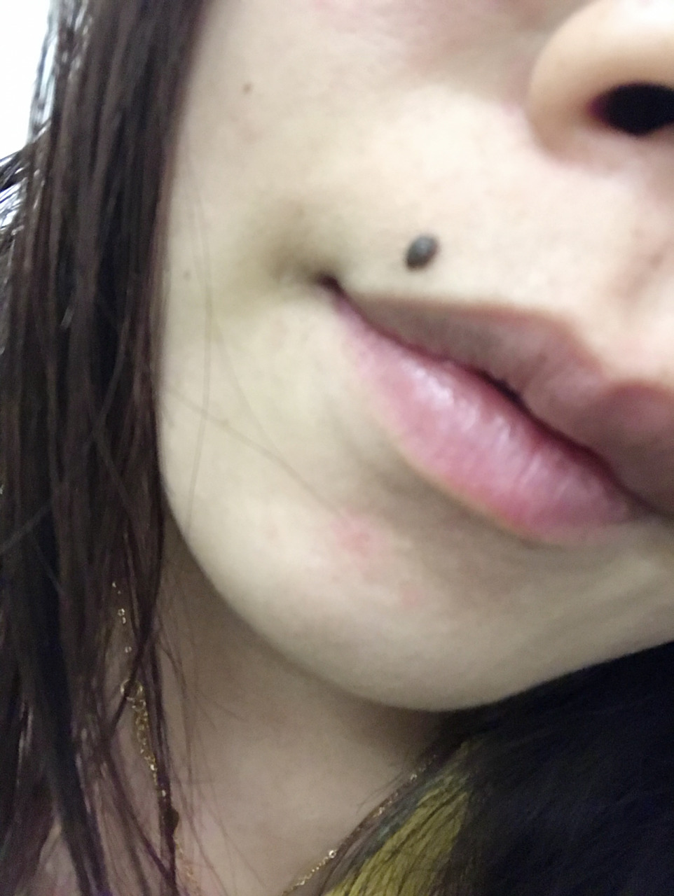 嘴上这个痣 我嘴上这个痣 要不要去激光打去～纠结中 有人说这是口福